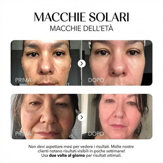 Rosyra Siero Anti-Macchie