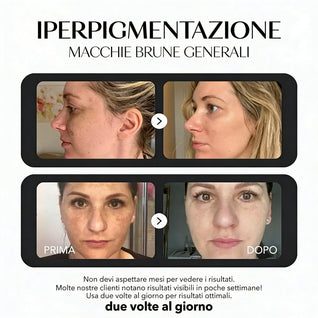 Rosyra Siero Anti-Macchie