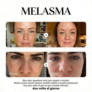 Rosyra Siero Anti-Macchie